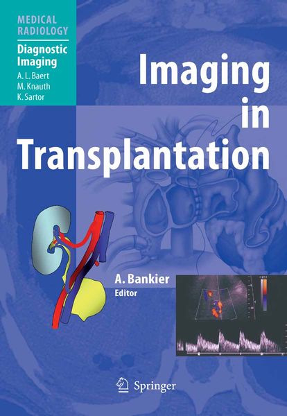 Produktbild: Imaging in Transplantation