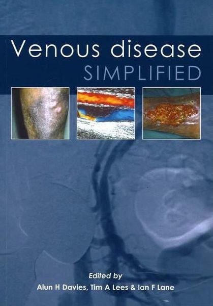 Produktbild: Venous Disease Simplified