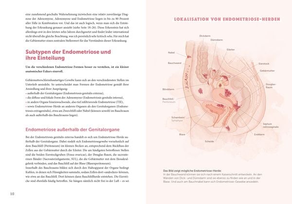 Produktbild: Endometriose &ndash; Die untersch&auml;tzte Krankheit