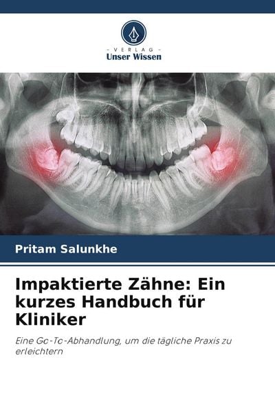 Impaktierte Zähne: Ein kurzes Handbuch für Kliniker, Taschenbuch von Pritam Salunkhe, Verlag Unser Wissen, 9786205227985