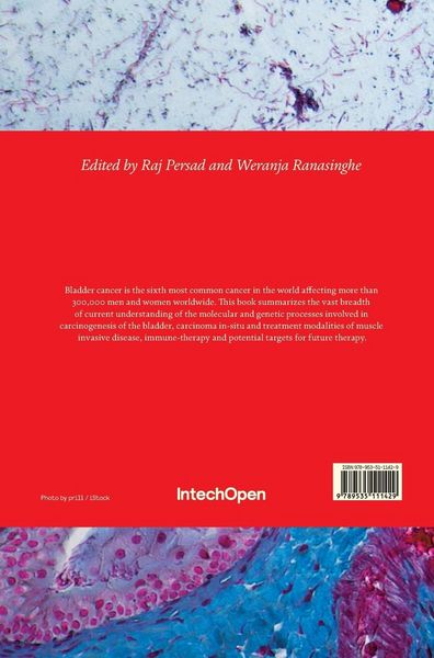 Produktbild: Advances in the Scientific Evaluation of Bladder Cancer and Molecular Basis for Diagnosis and Treatment