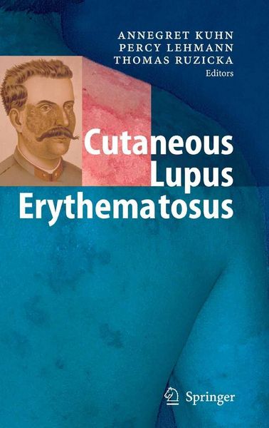 Produktbild: Cutaneous Lupus Erythematosus