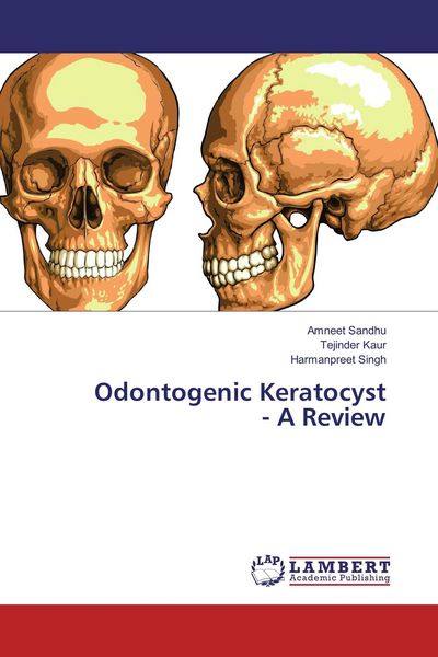 Produktbild: Odontogenic Keratocyst - A Review