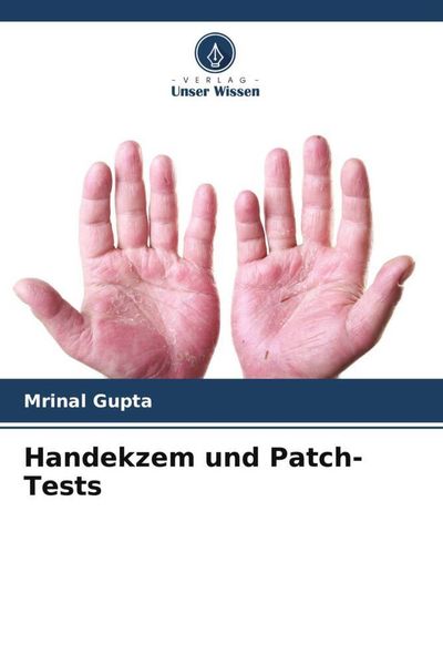Handekzem und Patch-Tests, Taschenbuch von Mrinal Gupta, Verlag Unser Wissen, 9786205476659