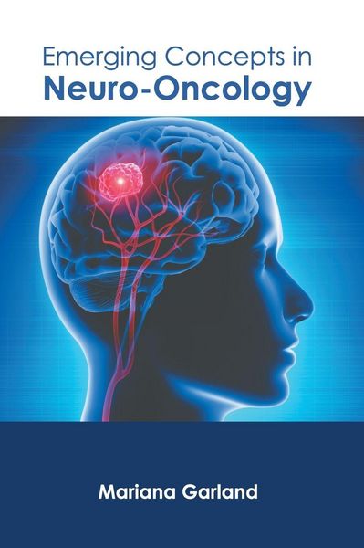 Produktbild: Emerging Concepts in Neuro-Oncology