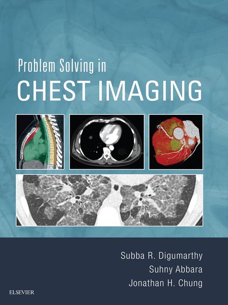 Produktbild: Problem Solving in Chest Imaging E-Book