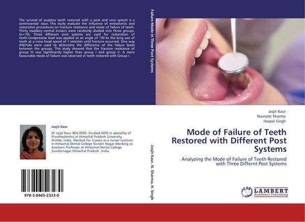 Produktbild: Mode of Failure of Teeth Restored with Different Post Systems