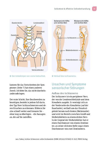 Produktbild: Ischias-Schmerzen selbst behandeln