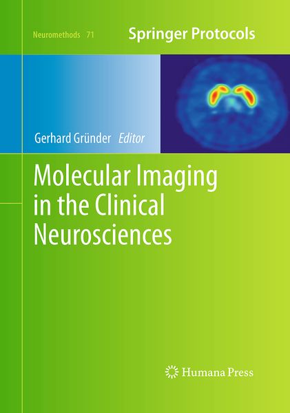 Produktbild: Molecular Imaging in the Clinical Neurosciences