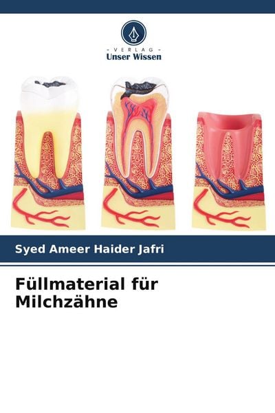 Füllmaterial für Milchzähne, Taschenbuch von Syed Ameer Haider Jafri, Verlag Unser Wissen, 9786209918704