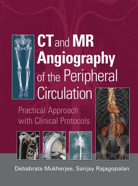 Produktbild: CT and MR Angiography of the Peripheral Circulation