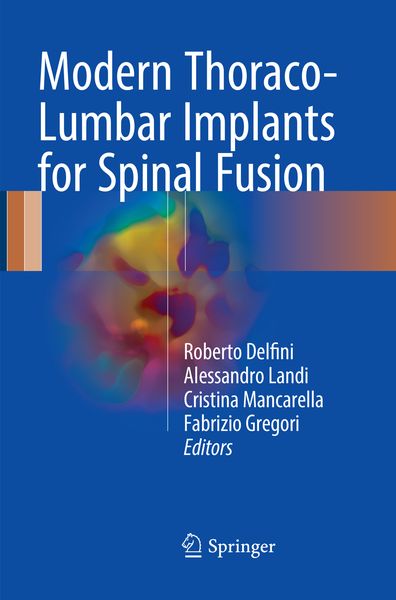 Produktbild: Modern Thoraco-Lumbar Implants for Spinal Fusion
