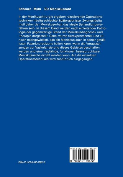 Produktbild: Die Meniskusnaht