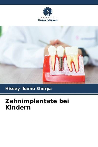Zahnimplantate bei Kindern, Taschenbuch von Hissey lhamu Sherpa, Verlag Unser Wissen, 9786205039656