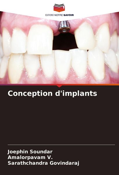 Produktbild: Conception d'implants