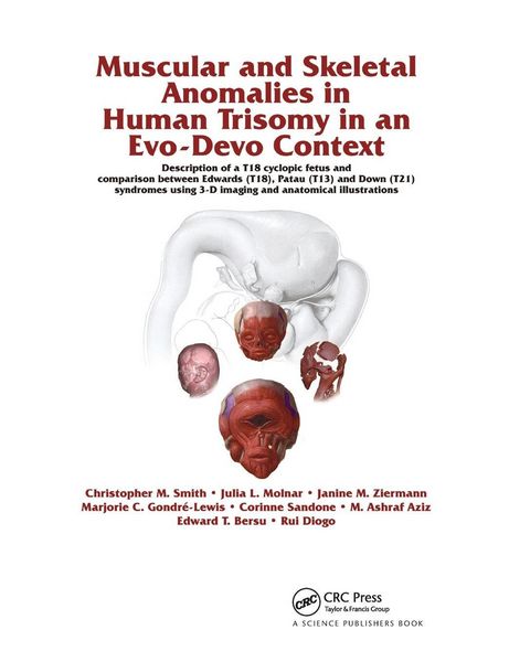 Produktbild: Muscular and Skeletal Anomalies in Human Trisomy in an Evo-Devo Context
