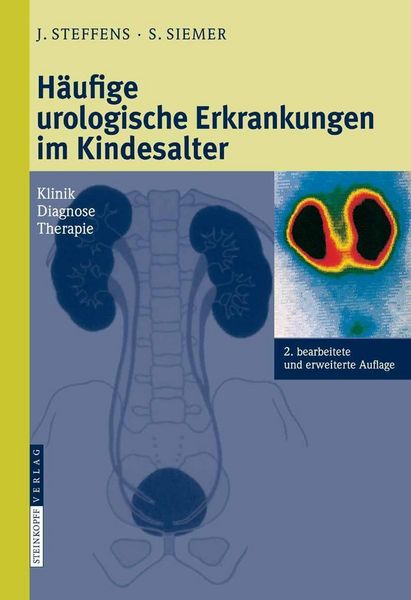 Produktbild: H&auml;ufige urologische Erkrankungen im Kindesalter