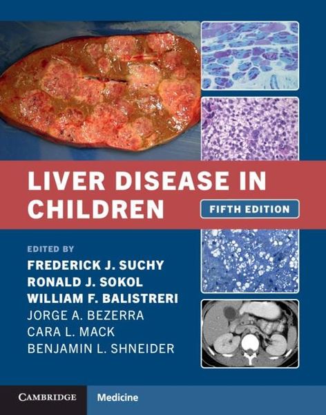 Produktbild: Liver Disease in Children