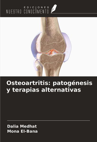 Produktbild: Osteoartritis: patog&eacute;nesis y terapias alternativas