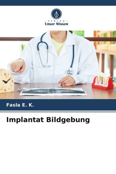 Implantat Bildgebung, Taschenbuch von Fasla E. K., Verlag Unser Wissen, 9786204706986