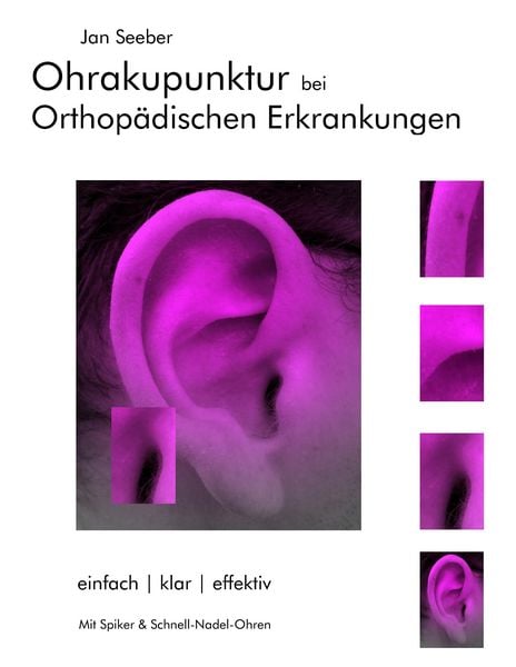 Produktbild: Ohrakupunktur bei Orthop&auml;dischen Erkrankungen