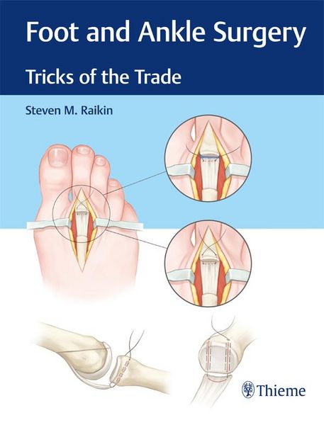 Produktbild: Foot and Ankle Surgery