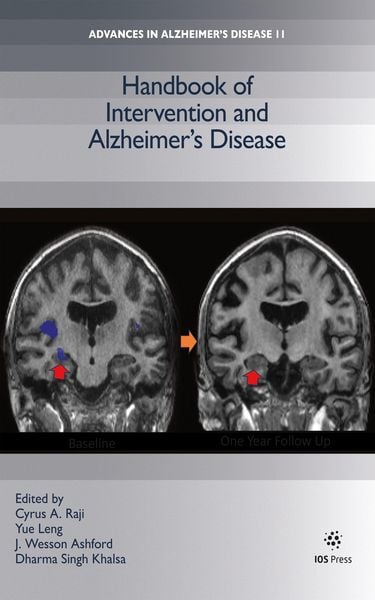 Produktbild: Handbook of Intervention and Alzheimer's Disease