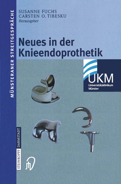 Produktbild: Neues in der Knieendoprothetik