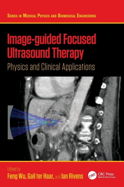 Produktbild: Image-guided Focused Ultrasound Therapy