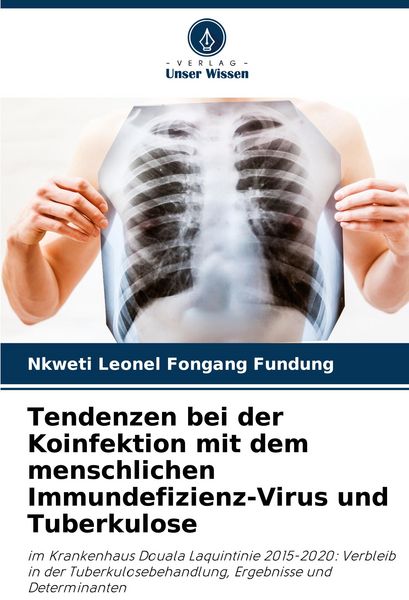 Produktbild: Tendenzen bei der Koinfektion mit dem menschlichen Immundefizienz-Virus und Tuberkulose