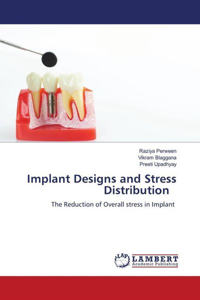 Produktbild: Implant Designs and Stress Distribution