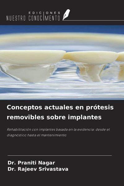 Produktbild: Conceptos actuales en pr&oacute;tesis removibles sobre implantes
