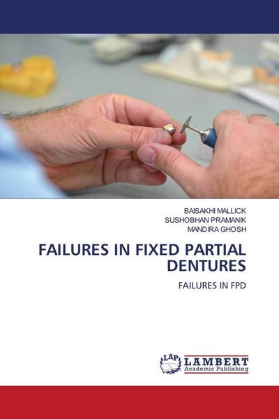 Produktbild: FAILURES IN FIXED PARTIAL DENTURES