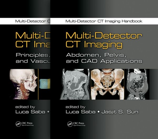 Produktbild: Multi-Detector CT Imaging Handbook, Two Volume Set