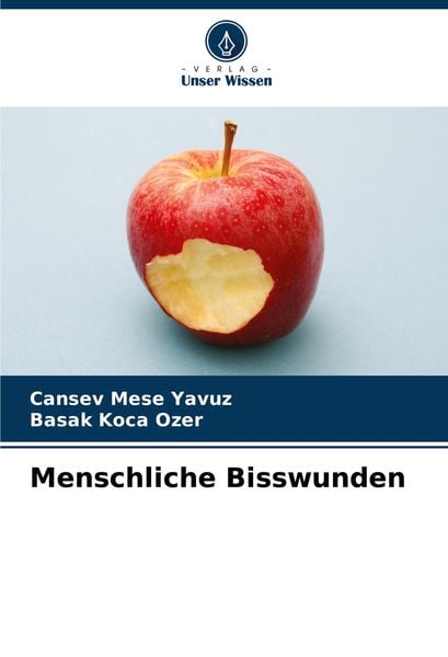Produktbild: Menschliche Bisswunden