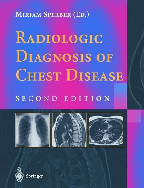 Produktbild: Radiologic Diagnosis Of Chest