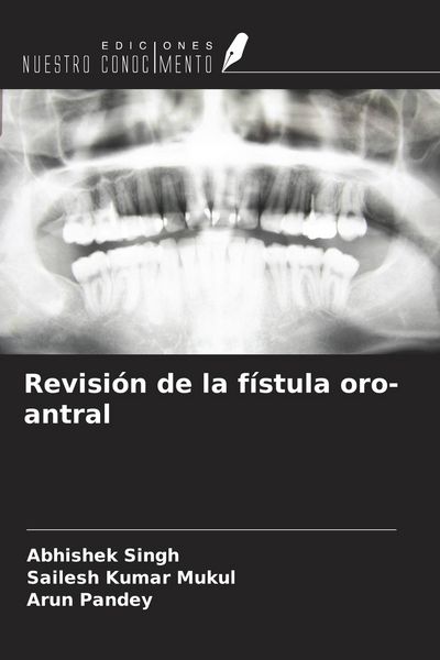 Produktbild: Revisi&oacute;n de la f&iacute;stula oro-antral