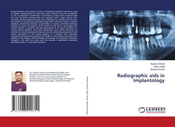Produktbild: Radiographic aids in Implantology
