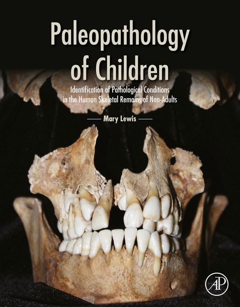 Produktbild: Paleopathology of Children