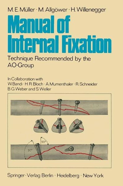 Produktbild: Manual of Internal Fixation