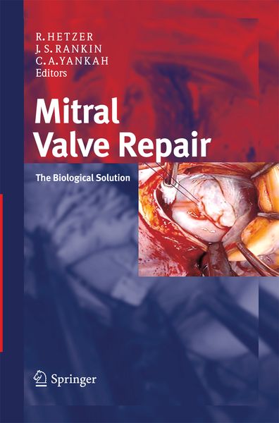 Produktbild: Mitral Valve Repair