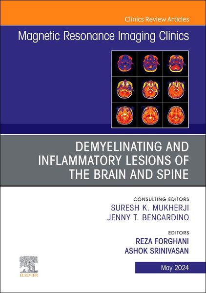 Produktbild: Demyelinating and Inflammatory Lesions of the Brain and Spine, an Issue of Magnetic Resonance Imaging Clinics of North America