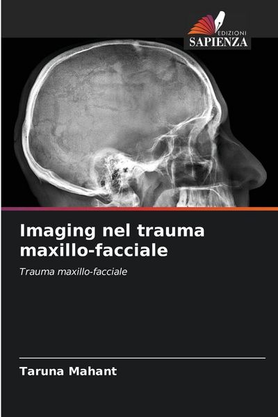 Produktbild: Imaging nel trauma maxillo-facciale
