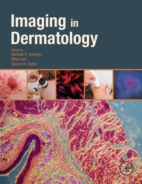 Produktbild: Imaging in Dermatology