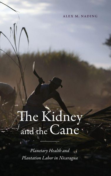 Produktbild: The Kidney and the Cane