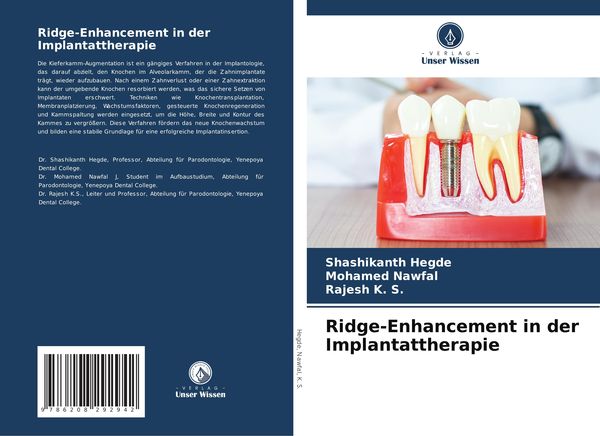 Produktbild: Ridge-Enhancement in der Implantattherapie