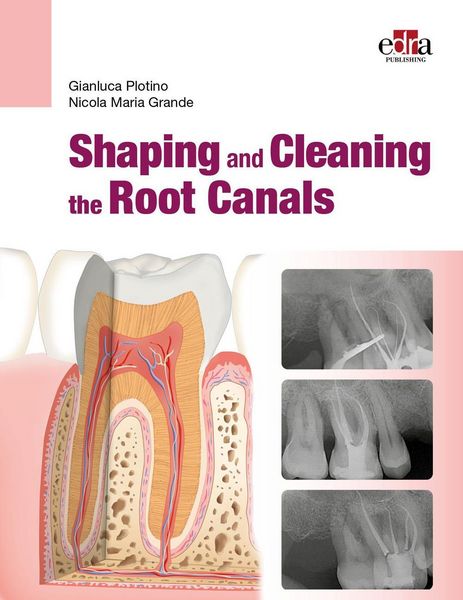 Produktbild: Shaping and Cleaning the Root Canals