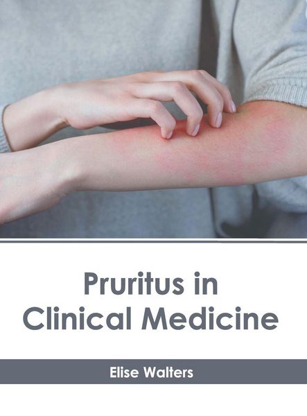 Produktbild: Pruritus in Clinical Medicine