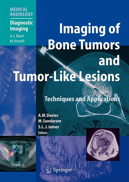 Produktbild: Imaging of Bone Tumors and Tumor-Like Lesions