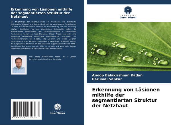 Produktbild: Erkennung von L&auml;sionen mithilfe der segmentierten Struktur der Netzhaut